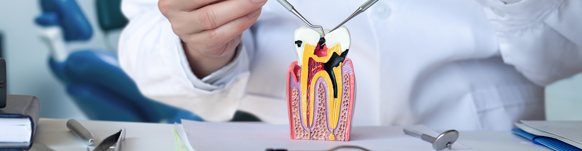 dentist using dental tools to touch tooth model with exposed anatomy